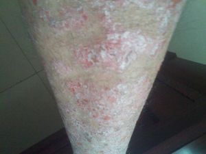 牛皮癣又发作了怎么办